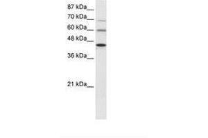 Image no. 1 for anti-Protein Arginine Methyltransferase 3 (PRMT3) (AA 221-270) antibody (ABIN6736023) (PRMT3 抗体  (AA 221-270))