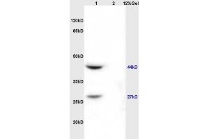 Lane 1: rat kidney lysates Lane 2: rat brain lysates probed with Anti AVPR2 Polyclonal Antibody, Unconjugated (ABIN674619) at 1:200 in 4 °C. (DIABLO 抗体  (AA 131-239))