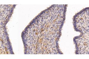 Detection of TGM2 in Human Uterus Tissue using Polyclonal Antibody to Transglutaminase 2 (TGM2) (Transglutaminase 2 抗体  (AA 1-687))