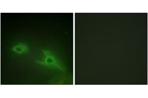 Immunofluorescence analysis of HeLa cells, using EPHA1 Antibody. (EPHA1 抗体  (AA 541-590))