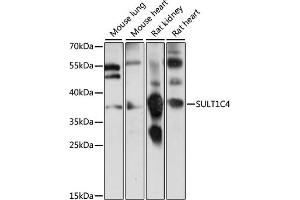 Western blot analysis of extracts of various cell lines, using SULT1C4 antibody (ABIN7270630) at 1:1000 dilution. (SULT1C4 抗体  (AA 1-95))