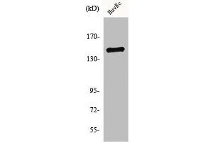 Western Blot analysis of HuvEc cells using SHIP-1 Polyclonal Antibody (INPP5D 抗体  (C-Term))