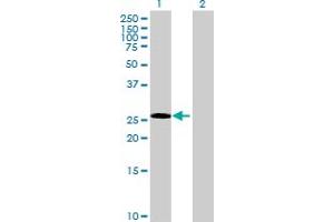 Western Blot analysis of ECE2 expression in transfected 293T cell line by ECE2 MaxPab polyclonal antibody. (ECE2 抗体  (AA 1-255))