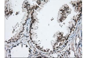 Immunohistochemical staining of paraffin-embedded Human pancreas tissue using anti-TACC3 mouse monoclonal antibody. (TACC3 抗体)