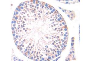 Immunohistochemistry (IHC) image for anti-Nuclear Receptor Subfamily 6, Group A, Member 1 (NR6A1) (AA 282-480) antibody (ABIN5013607)