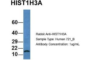 Host: Rabbit Target Name: HIST1H3A Sample Type: Human 721_B Antibody Dilution: 1. (HIST1H3A 抗体  (N-Term))