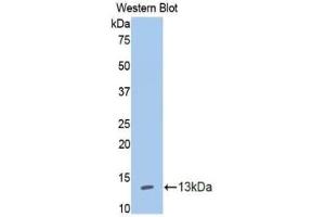 Western blot analysis of the recombinant protein. (IL13 Receptor alpha 1 抗体  (AA 137-210))