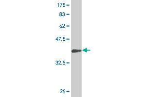 Western Blot detection against Immunogen (44. (SDHC 抗体  (AA 1-169))