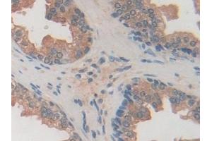 Detection of USP7 in Human Prostate Tissue using Polyclonal Antibody to Ubiquitin Specific Peptidase 7 (USP7) (USP7 抗体  (AA 54-507))