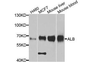 Western blot analysis of extracts of various cell lines, using ALB antibody. (Albumin 抗体  (AA 20-255))