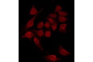 ABIN6267551 staining HeLa by IF/ICC. (STAT2 抗体  (pTyr690))