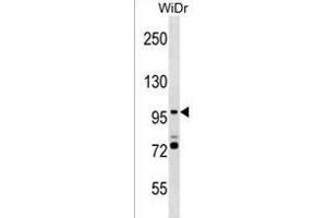 Western Blotting (WB) image for anti-Smg-5 Homolog, Nonsense Mediated mRNA Decay Factor (SMG5) (AA 912-941), (C-Term) antibody (ABIN1537651)