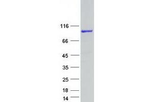 C1orf116 Protein (Transcript Variant 1) (Myc-DYKDDDDK Tag)