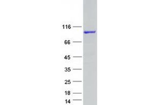 C1orf116 Protein (Transcript Variant 1) (Myc-DYKDDDDK Tag)