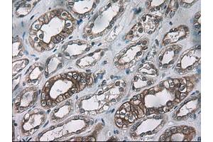 Image no. 1 for anti-Keratin 18 (KRT18) (AA 69-372) antibody (ABIN1491639) (Cytokeratin 18 抗体  (AA 69-372))
