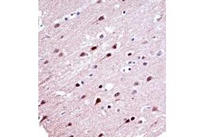 Immunohistochemistry analysis in formalin fixed and paraffin embedded human brain tissue reacted with  KCND2 Antibody (N-term) followed which was peroxidase conjugated to the secondary antibody and followed by DAB staining. (KCND2 抗体  (N-Term))