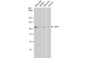 WB Image Various whole cell extracts (30 μg) were separated by 7.