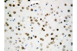 IHC-P: Apoptosis Inhibitor 5 antibody testing of rat brain tissue