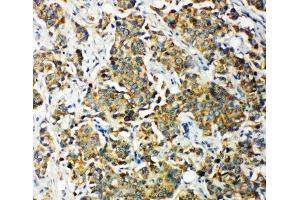 Immunohistochemistry (IHC) image for anti-Pyruvate Dehydrogenase Kinase, Isozyme 2 (PDK2) (C-Term) antibody (ABIN3032416)