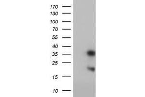 Western Blotting (WB) image for anti-Frataxin (FXN) antibody (ABIN1498335) (Frataxin 抗体)