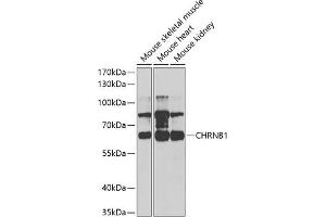 Western blot analysis of extracts of various cell lines, using CHRNB1 antibody (ABIN6131211, ABIN6138587, ABIN6138588 and ABIN6220911) at 1:1000 dilution. (CHRNB1 抗体  (AA 25-235))