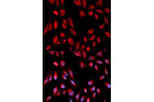 Immunofluorescence (IF) image for anti-Hydroxysteroid (17-Beta) Dehydrogenase 10 (HSD17B10) antibody (ABIN1876636) (HSD17B10 抗体)