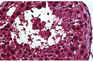 Human Testis: Formalin-Fixed, Paraffin-Embedded (FFPE) (Retinoic Acid Receptor alpha 抗体  (AA 315-425))