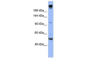 INSR antibody used at 1 ug/ml to detect target protein. (Insulin Receptor 抗体  (Middle Region))
