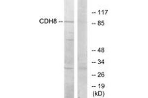 Western Blotting (WB) image for anti-Cadherin 8 (CDH8) (AA 491-540) antibody (ABIN2889888) (Cadherin 8 抗体  (AA 491-540))