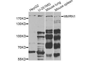 Western blot analysis of extracts of various cell lines, using MMRN1 Antibody. (Multimerin 1 抗体)