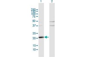 Western Blot analysis of TMEM126B expression in transfected 293T cell line by TMEM126B MaxPab polyclonal antibody. (TMEM126B 抗体  (AA 1-200))