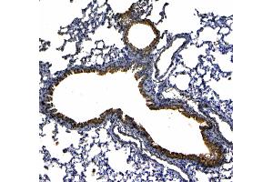 IHC analysis of Uteroglobin using anti-Uteroglobin antibody . (SCGB1A1 抗体  (AA 20-96))