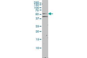 NR1H2 monoclonal antibody (M01), clone 2H2-H3 Western Blot analysis of NR1H2 expression in LNCaP . (NR1H2 抗体  (AA 1-461))