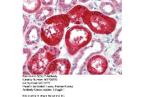 Rabbit Anti-SOX17 Antibody  Paraffin Embedded Tissue: Human Kidney Antibody Concentration: 5 ug/ml (SOX17 抗体  (Middle Region))