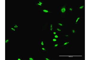 Immunofluorescence of purified MaxPab antibody to SCML1 on HeLa cell. (SCML1 抗体  (AA 1-208))