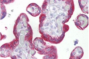 Immunohistochemistry with Placenta tissue at an antibody concentration of 5µg/ml using anti-KRT23 antibody (ARP47466_P050) (KRT23 抗体  (Middle Region))