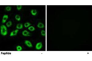 Immunofluorescence analysis of A-549 cells, using ATP5D polyclonal antibody . (ATP5F1D 抗体)