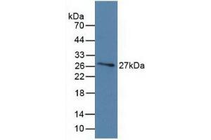 Detection of Recombinant DBP, Human using Monoclonal Antibody to Vitamin D Binding Protein (DBP) (Vitamin D-Binding Protein 抗体  (AA 209-401))