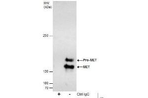 Immunoprecipitation (IP) image for anti-Met Proto-Oncogene (MET) (C-Term) antibody (ABIN2854819)