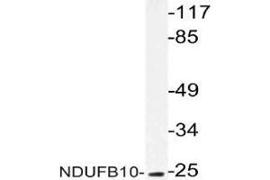 Western blot (WB) analysis of NDUFB10 antibody in extracts from COLO cells.