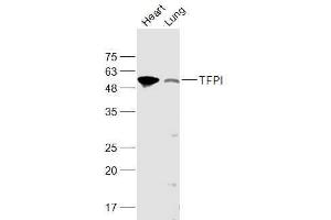 Lane 1: Mouse Heart lysates Lane 2: Rat Lung lysates probed with TFPI Polyclonal Antibody, Unconjugated  at 1:1000 dilution and 4˚C overnight incubation. (TFPI 抗体  (AA 101-200))