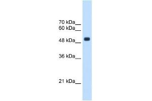 CXORF34 antibody used at 2. (TRMT2B 抗体  (Middle Region))