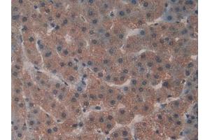 Detection of GaA in Human Liver Tissue using Polyclonal Antibody to Glucosidase Alpha, Acid (GaA) (GAA 抗体  (AA 595-770))