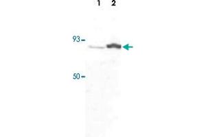 Western blot was performed using whole cell extracts (WCE) from drosophila larva (Lane 1) and drosophila adults (Lane 2) and the CDC73 polyclonal antibody  at dilution 1 : 1,000 in TBS-Tween + 5% skimmed milk. (HRPT2 抗体)