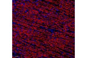 Immunofluorescence (Paraffin-embedded Sections) (IF (p)) image for anti-ATP Synthase, H+ Transporting, Mitochondrial F0 Complex, Subunit C1 (Subunit 9) (ATP5G1) antibody (ABIN7073141)