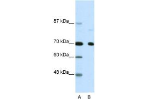 WB Suggested Anti-NCOR2 Antibody Titration:  2. (NCOR2 抗体  (N-Term))