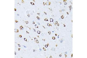 Immunohistochemistry of paraffin-embedded rat brain using BiP/GRP78 antibody (ABIN3020762, ABIN3020763, ABIN3020764, ABIN1512637 and ABIN6213711) at dilution of 1:100 (40x lens). (GRP78 抗体  (AA 550-650))