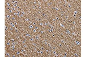 The image is immunohistochemistry of paraffin-embedded Human brain tissue using ABIN7191618(NEFM Antibody) at dilution 1/20. (NEFM 抗体)