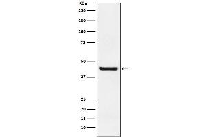 Western blot analysis of Septin 2 expression in Jurkat cell lysate.