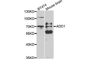 Western blot analysis of extracts of various cell lines, using ADD1 antibody (ABIN5970770) at 1/500 dilution. (alpha Adducin 抗体)